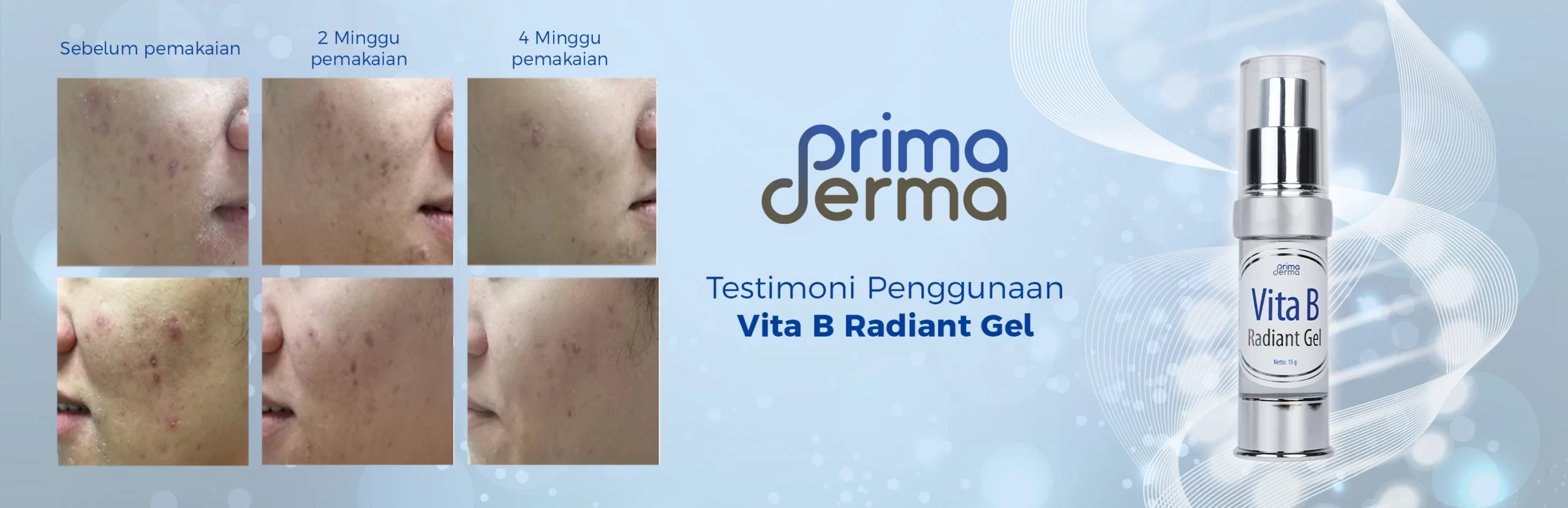 review primaderma acne
