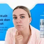 Lindungi Kulit Berminyak dan berjerawat: Manfaat niacinamide dan Rekomendasi Produk yang Aman untuk kulitmu!